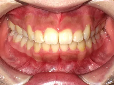 SHOFU DENTAL DIGITAL CAMERA